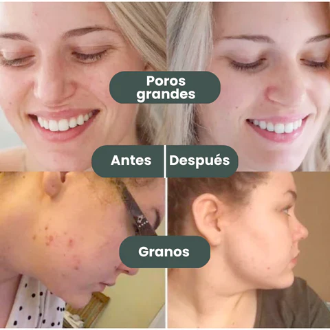 Crystal Skin™️ - Mascarilla en Barra Enriquecida con Té Verde